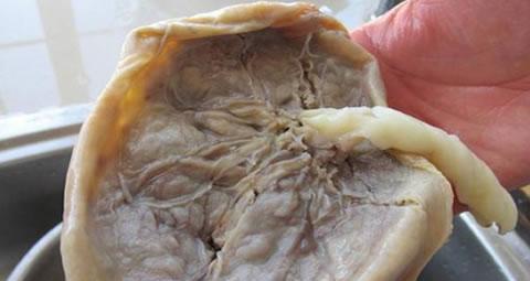 它是由羊膜,叶状绒毛膜和底蜕膜一起构成的.