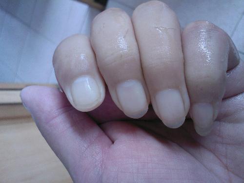 肝脏出事的求救信号三:指甲变成苍白色.