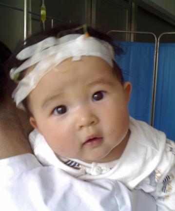 面对宝宝发烧,及时就医or自己护理?