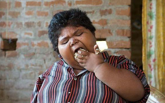 印度最胖女童:9岁体重95公斤,一天到晚都是吃吃吃!