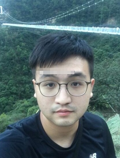 耳朵双珠朝口,福气不错,不过你的眉骨突出且眉毛浓,虽然比较重情义,但