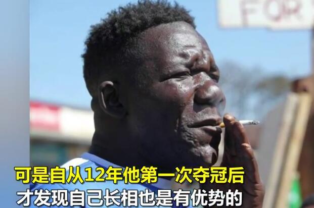 世界最丑的男人:四届选丑冠军,被人抗议不准参赛了