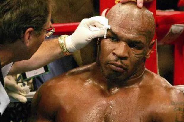 他们是不会请的,也因为这件事,泰森后来加入了wwe的名人堂