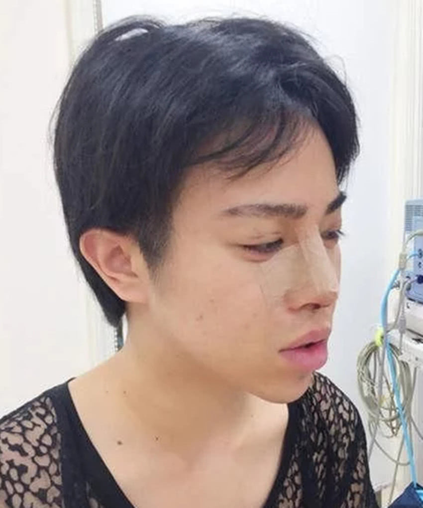 日本男子5年时间整容40余次,花费90万元,整容后变成"蛇精