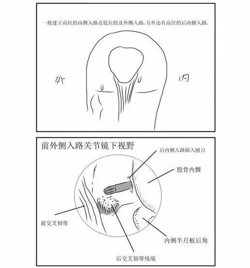 这份膝关节手绘图谱你一定不能错过