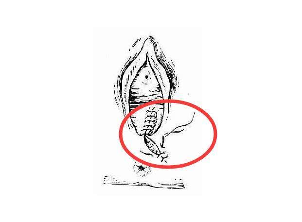 顺产无限好,只是怕侧切,孕期有什么办法减少侧切发生吗?