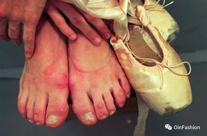 刘诗诗体态好气质佳,但她为什么对小脚丫遮遮