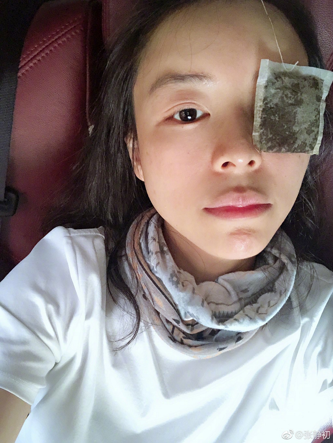 张静初拍戏哭肿眼睛 为消肿尝试各种办法