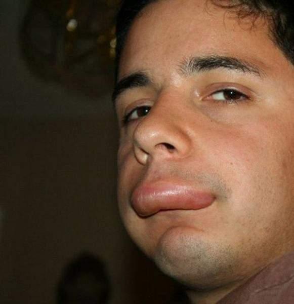 被蜜蜂"亲吻"之后的香肠嘴,看看他们就能笑喷了|蜜蜂|马蜂|蜂种_新浪