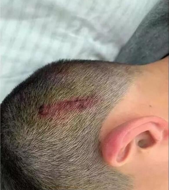 学生迟到两分钟遭老师殴打四把扫把都打断什么仇什么怨