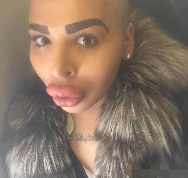 24岁男子花费百万巨资整容50次, 嘴唇又大又厚如同"香肠"!