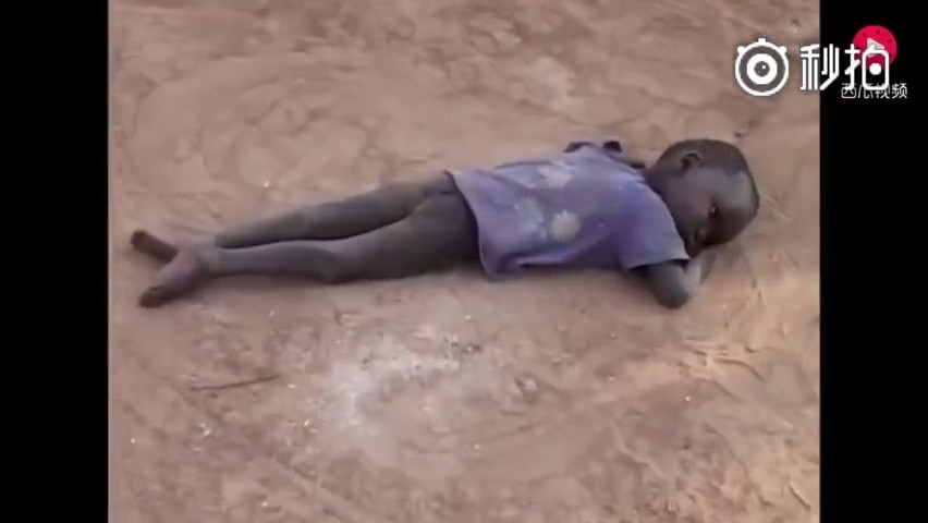 非洲儿童的惨状图片