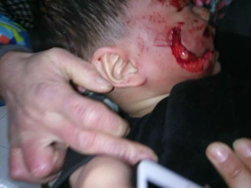 切记,春季让孩子远离宠物!|狗|恶狗|宠物_新浪新闻