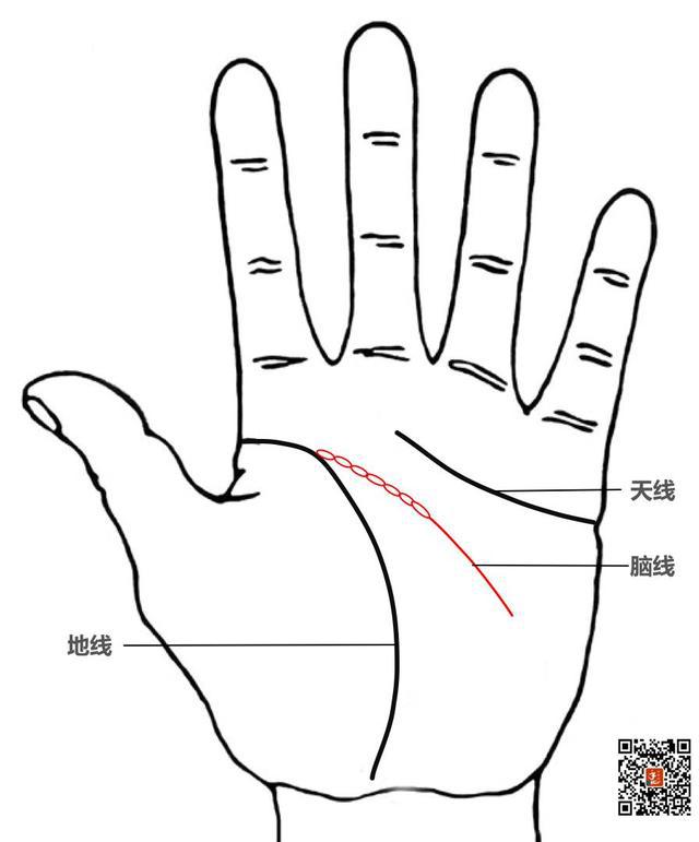 2,脑线出现断裂或呈锁链状. 掌纹特征 1,脑线断裂. 2,肝区扩大.