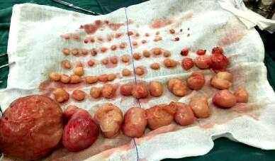 经历7次流产的女子, 肚子似怀孕4个月, 打开肚子后医生吓得腿发颤