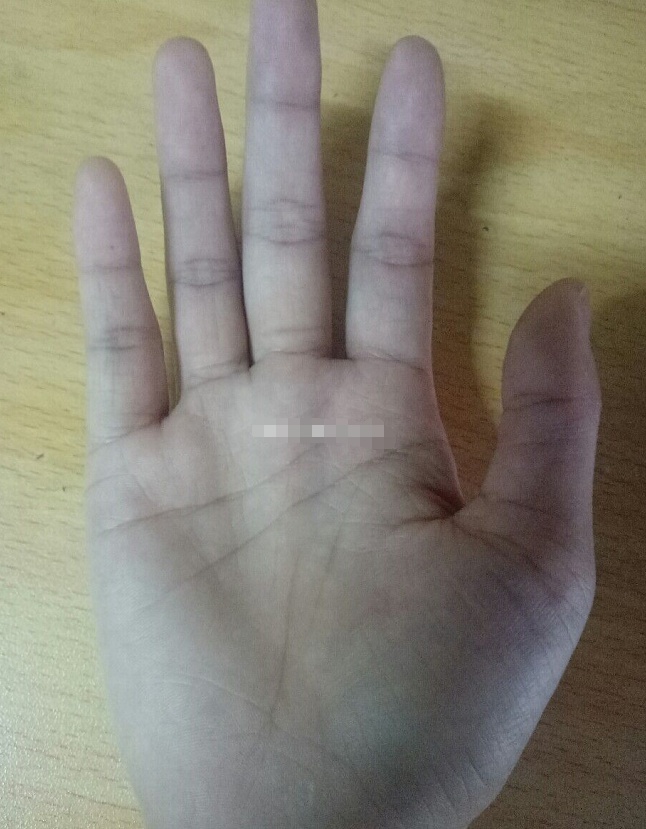 耳朵双珠朝口,福气不错,不过你的眉骨突出且眉毛浓,虽然比较重情义,但