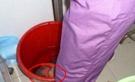 怀孕六个月狠心打掉孩子看到宝宝的那一刻连医生都泪崩了