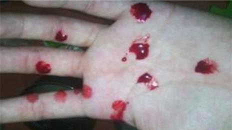 2岁男童流鼻血晕倒到医院后宣告死亡原因只是妈妈的一个动作