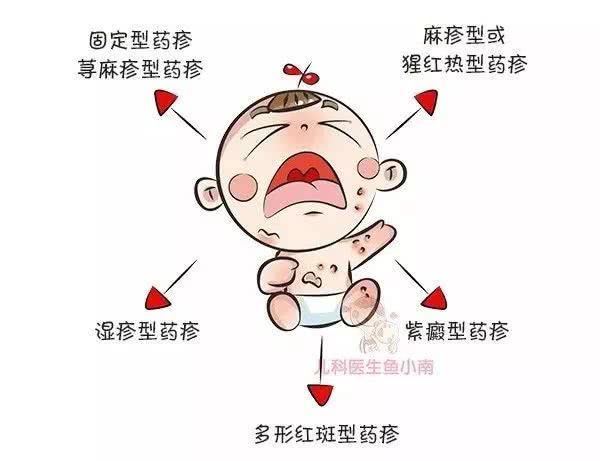 宝宝皮疹难区分手把手教你这样鉴别