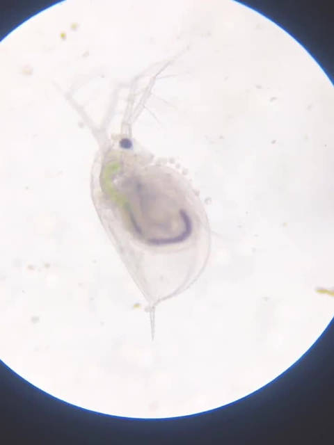 野外淡水里有很多微生物，有些对人体是有害的