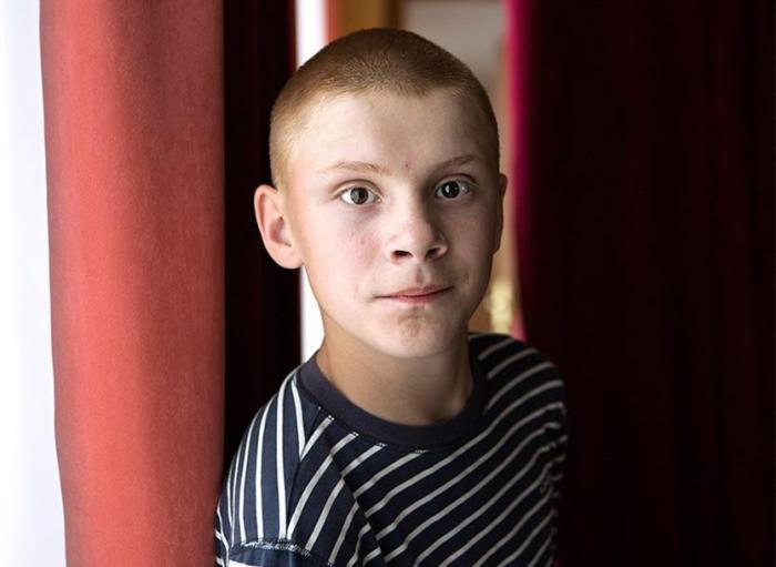 直击切尔诺贝利核事故受害者, 面部畸形, 40岁女人智商只有3岁!