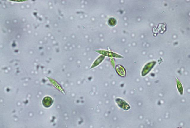 小水体,大世界--显微镜下的浮游生物,值得一看|轮虫|衣藻|伸缩_新浪新闻