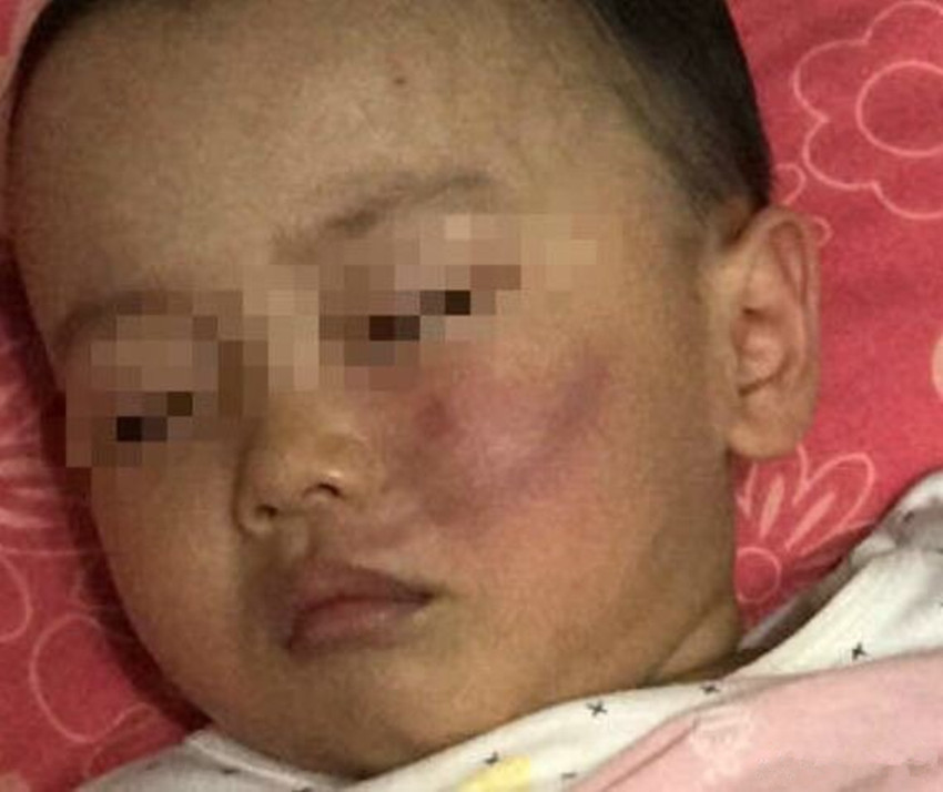 两岁男童从购物车被甩出,哭了几声照样玩,第二天却意外离开人世