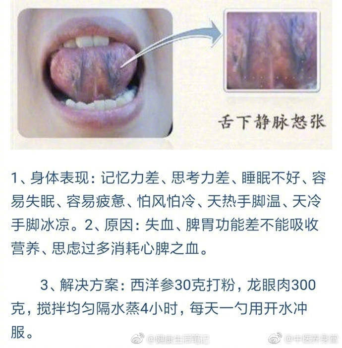 因为舌头是人体健康的"放大镜