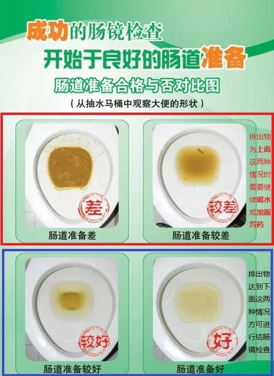 肠镜检查前如何清肠,请收下这份最详细的指南