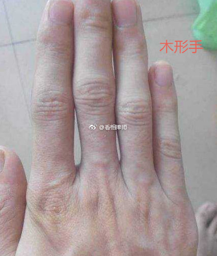 这5种手形的手掌 你是哪一种