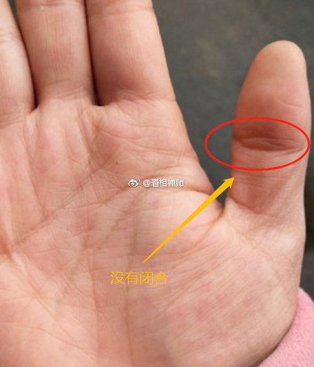 经常有粉丝问大拇指处是不是夫子眼这其实很容易辨认