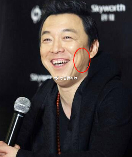 粉丝经常分不清楚什么是捧场纹和法令纹是有差别的