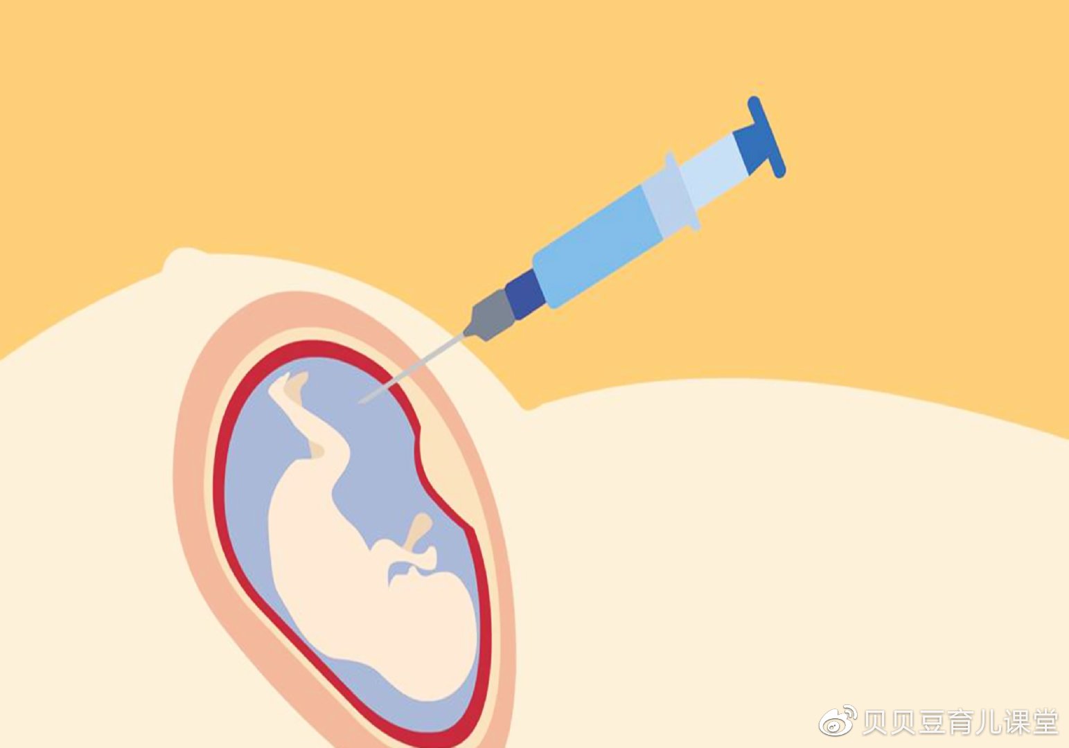 为啥现在唐筛结果普遍都是高危孕妈先别慌了神搞清这些很关键