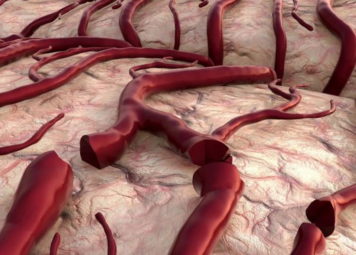 一旦出现3种迹象,小心血管"堵"了,这4类东西,最好少往嘴里塞