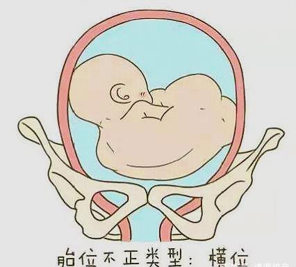 孕晚期,产检时这几个问题要提前问清,对孕妈和胎儿都有好处!