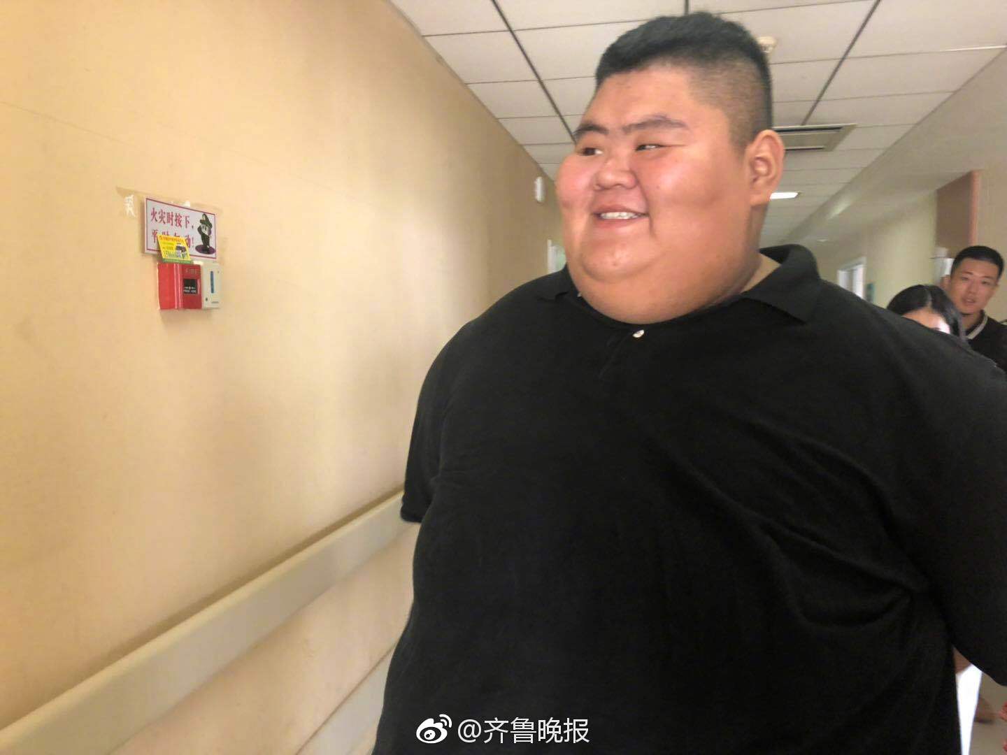原"第一胖"术后半年复查,体重已降至400斤以内