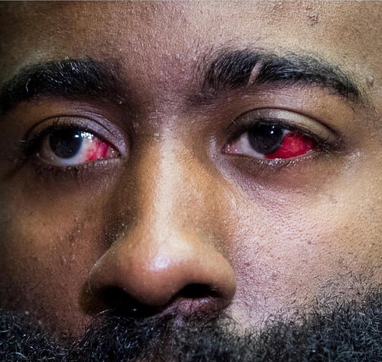 据记者chris hayens透露,一些勇士球员对于哈登眼睛受伤持怀疑态度