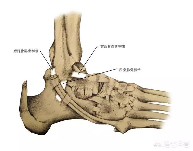 常被撕裂的踝关节外侧的跟骨腓骨韧带,和前外侧前距骨腓骨韧带
