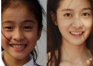10位童星今昔对比照,有的长残了,最好看的就是她