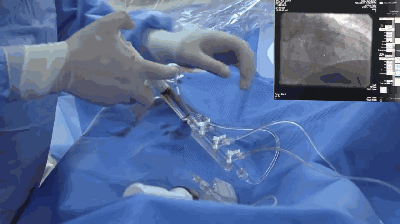 复查不做造影行不行