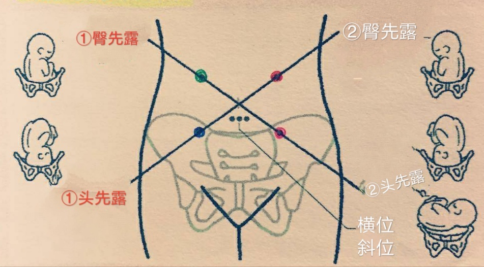 胎心|胎儿|肚脐_新浪新闻