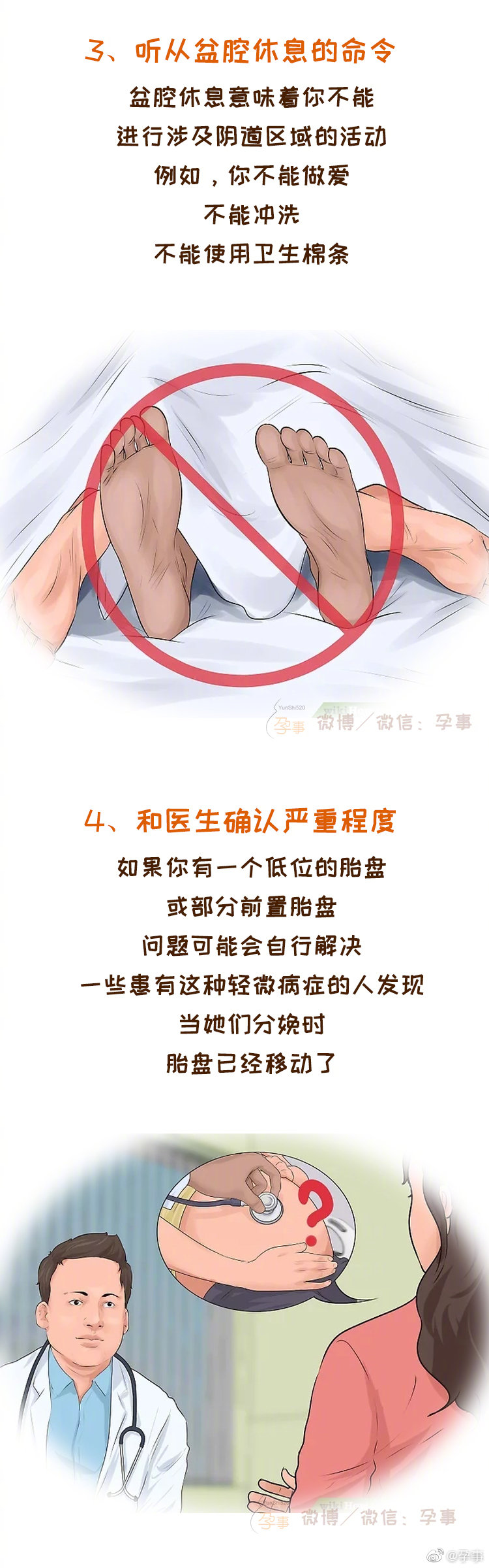 遇上前置胎盘别着急 这四个步骤帮你平安度过孕期