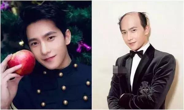 男星秃顶,胡歌颜值打折,杨洋中年油腻,鹿晗像谢广坤?