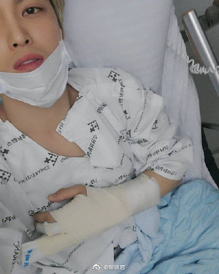 金在中晒打着石膏的胳膊照片,好心疼啊