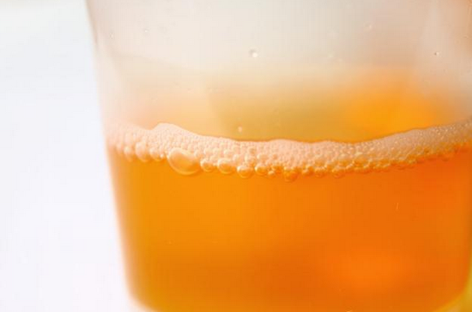 若尿液呈现深黄色或浓茶色,可能是肝脏出了问题.