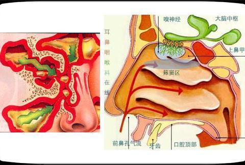 上颌窦炎不能吃什么？|上颌窦炎|头痛|粘膜_新浪新闻