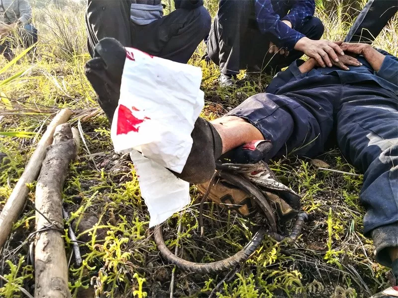 上林77岁老人被野猪夹夹伤,拖夹爬行4天获救!
