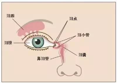 鼻泪管堵塞,又称新生儿泪囊炎,是鼻泪管下端鼻腔开口处被先天性膜组织