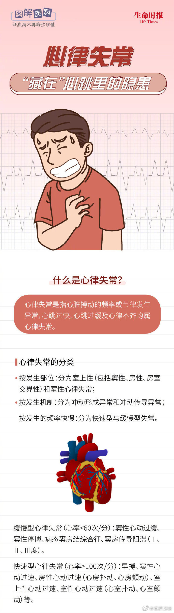 心律失常,你的心跳是这样不听"指挥"的