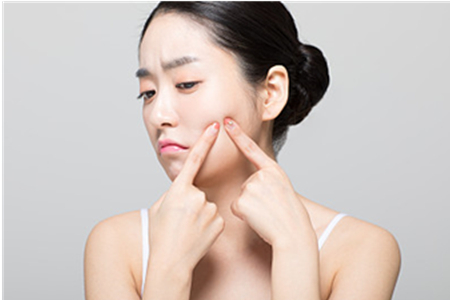 坚持这个原则,清痘就是容易